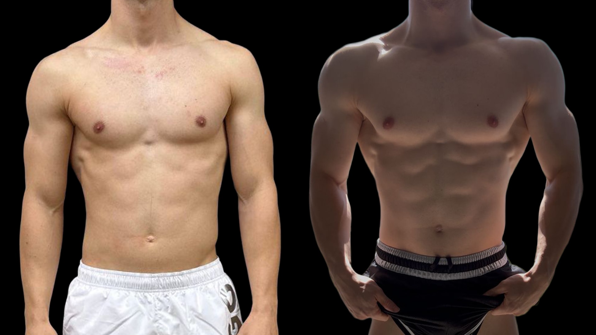 Antes e depois de Felipe, paciente do Caian Maroni